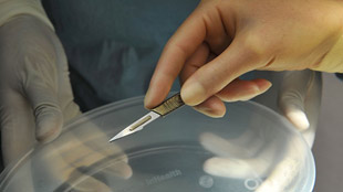 Surgeon holding a scalpel